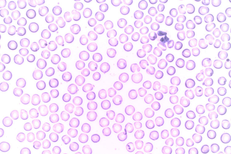 白血球のイメージ写真